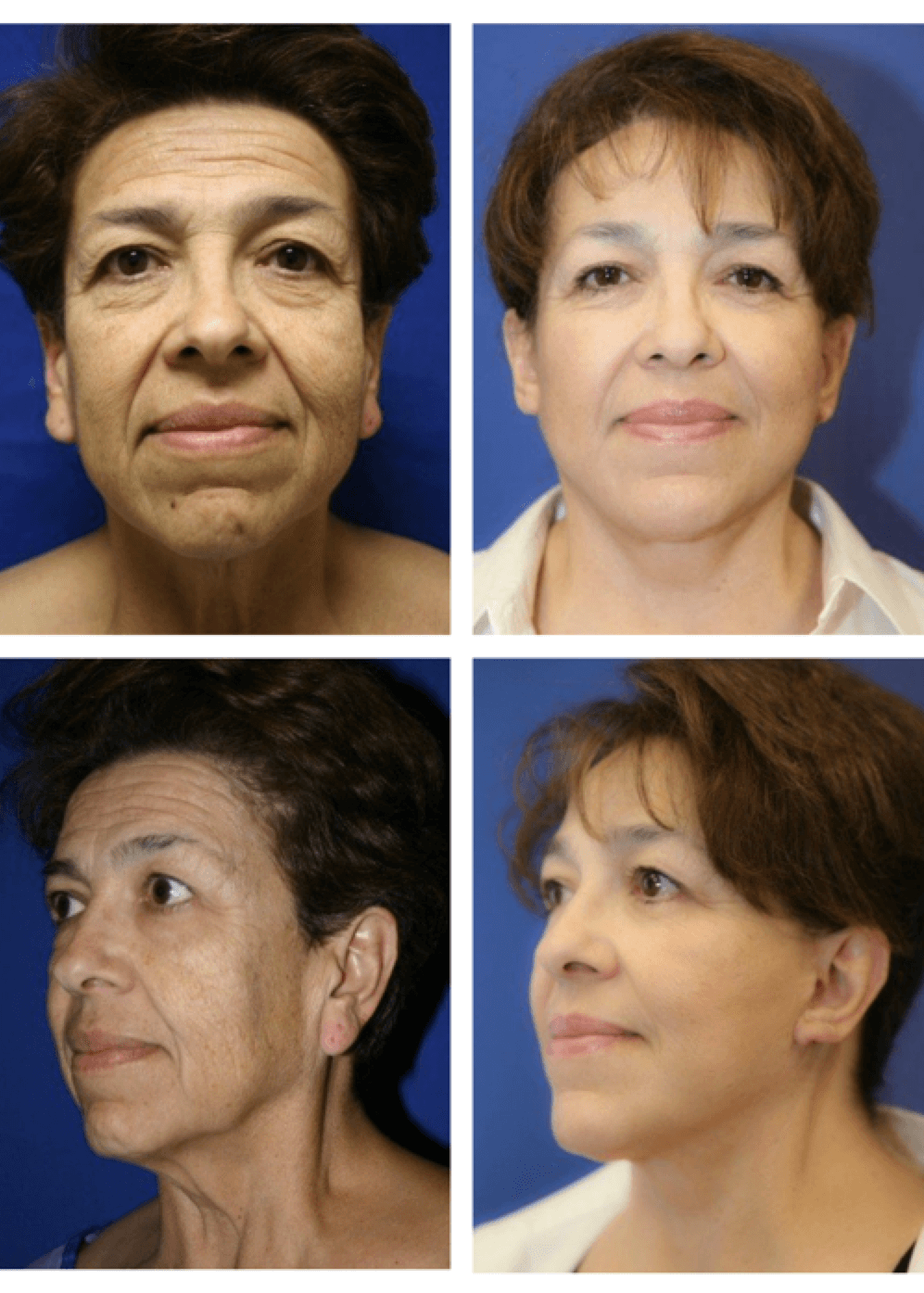 face before and after